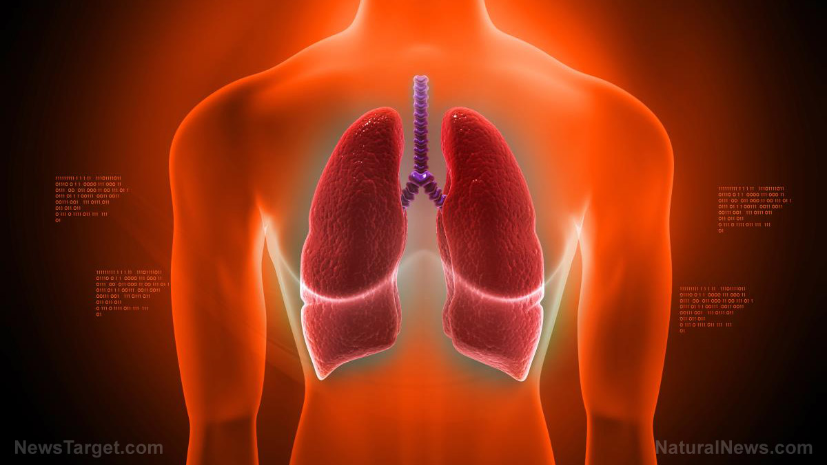 Lung cancer without smoking